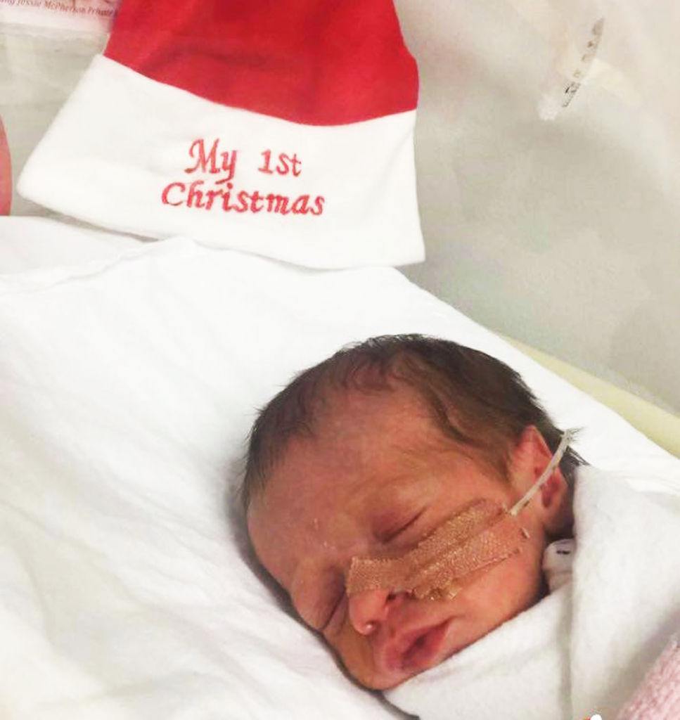 Premature baby sleeping in a cot with a feeding tube taped onto her face. Behind her is a red Santa hat that reads 'My First Christmas'.